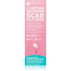 MomCare by Lina C-Section Silicone Scar Patches szilikontapasz császármetszés utáni hegekre méret L-XL 5 x 20 cm 3 db-Ár