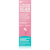 MomCare by Lina C-Section Silicone Scar Patches szilikontapasz császármetszés utáni hegekre méret S-M 3x15 cm 3 db-Ár